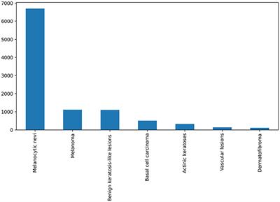 LesionNet: an automated approach for skin lesion classification using SIFT features with customized convolutional neural network